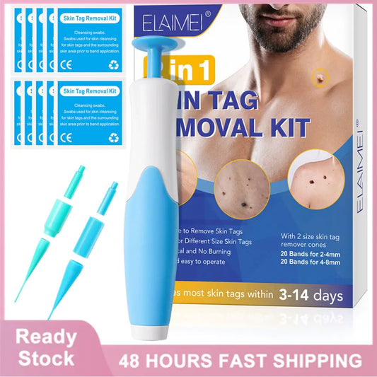 KozoMart™ 2-in-1 Skin Tag Remover Kit