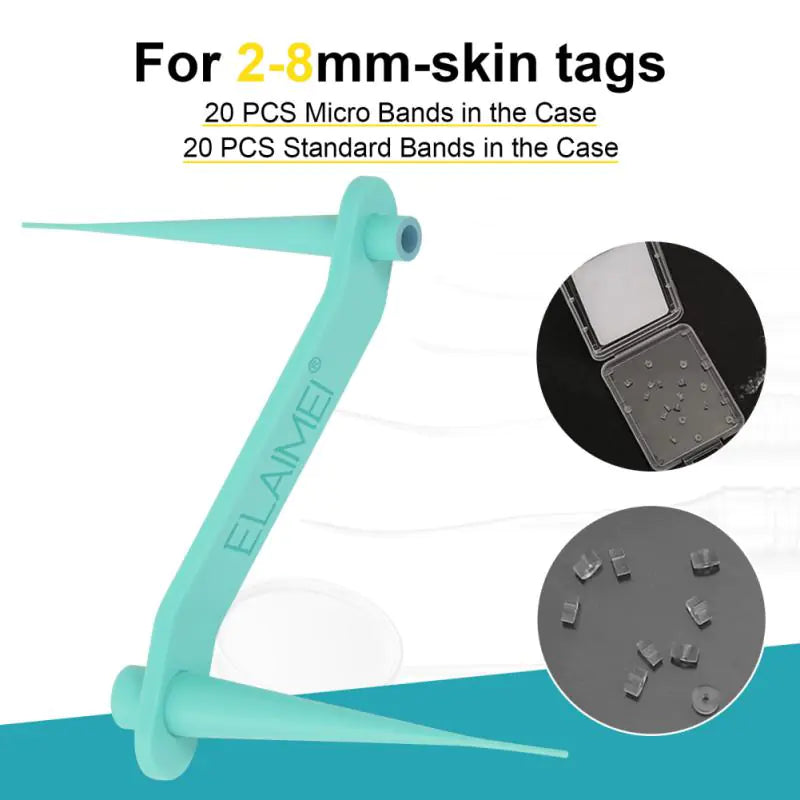 KozoMart™ 2-in-1 Skin Tag Remover Kit